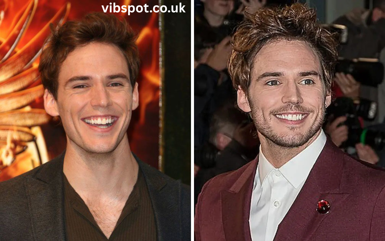 sam claflin veneers